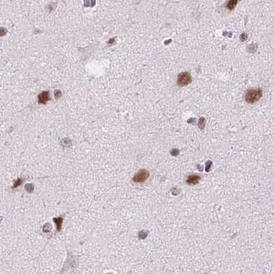 Immunohistochemistry-Paraffin: SETD1A Antibody [NBP2-49281]
