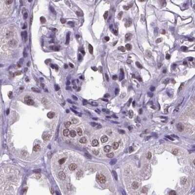 Immunohistochemistry-Paraffin: SETD1A Antibody [NBP2-49281]