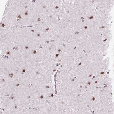 Immunohistochemistry-Paraffin: SETD1A Antibody [NBP2-49281]