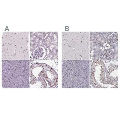 Immunohistochemistry-Paraffin: SETD1A Antibody [NBP2-49281]