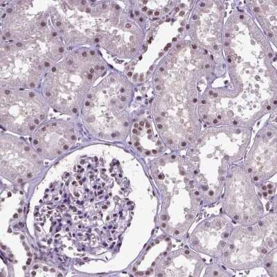 Immunohistochemistry-Paraffin: SETD1A Antibody [NBP2-49281]