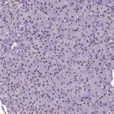 Immunohistochemistry-Paraffin: SETD1A Antibody [NBP2-49281]