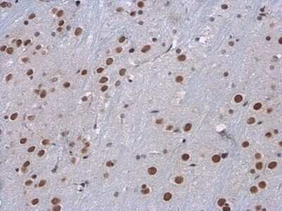 Immunohistochemistry-Paraffin: SETD1A Antibody [NBP3-12907]