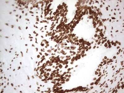 Immunohistochemistry: SETD1A Antibody (OTI7B7) - Azide and BSA Free [NBP2-74144]