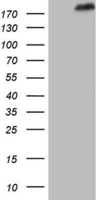 Western Blot: SETD1A Antibody (OTI7B7)Azide and BSA Free [NBP2-74144]