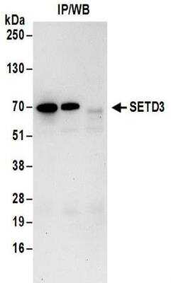 Immunoprecipitation: SETD3 Antibody [NBP2-32137]