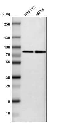 Western Blot: SETD3 Antibody [NBP1-88416]