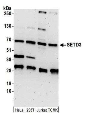 Western Blot: SETD3 Antibody [NBP2-32136]