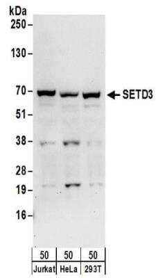 Western Blot: SETD3 Antibody [NBP2-32137]