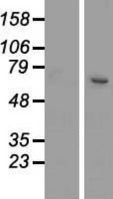 Western Blot: SETD3 Overexpression Lysate [NBP2-06055]