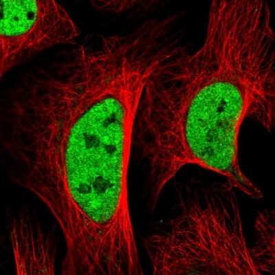 Immunocytochemistry/ Immunofluorescence: SETD5 Antibody [NBP2-38257]