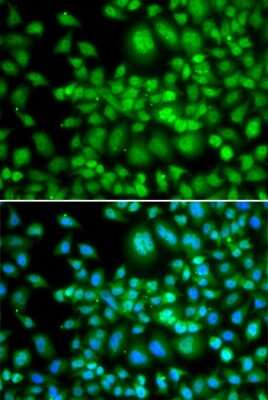 Immunocytochemistry/ Immunofluorescence: SETD5 Antibody - BSA Free [NBP3-05089]