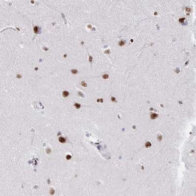 Immunohistochemistry-Paraffin: SETD5 Antibody [NBP2-38257]