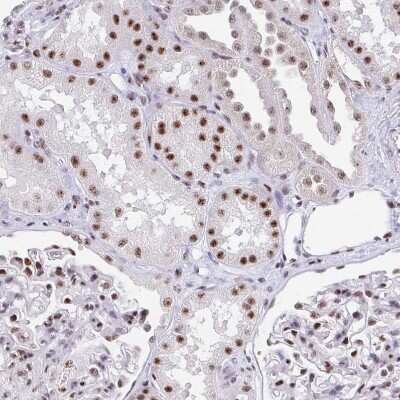 Immunohistochemistry-Paraffin: SETD5 Antibody [NBP2-38257]