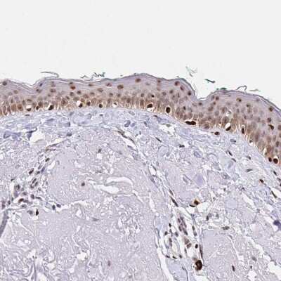 Immunohistochemistry-Paraffin: SETD5 Antibody [NBP2-38257]
