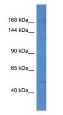 Western Blot: SETD5 Antibody [NBP1-74109]