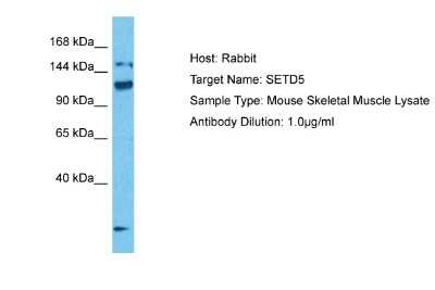Western Blot: SETD5 Antibody [NBP2-85710]