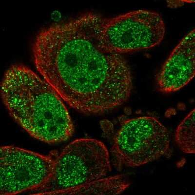 Immunocytochemistry/ Immunofluorescence: SETD6 Antibody [NBP2-58089]