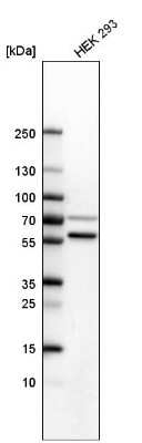 Western Blot: SETD6 Antibody [NBP1-93955]