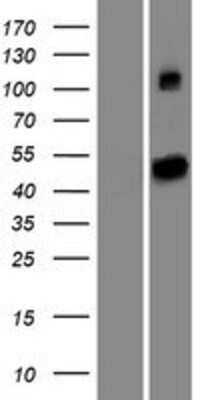 Western Blot: SETD6 Overexpression Lysate [NBP2-06275]