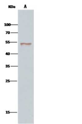 Immunoprecipitation: SETD7/9 Antibody [NBP2-99744]