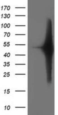 Western Blot: SETD7 Antibody (OTI2D10) [NBP2-01066]