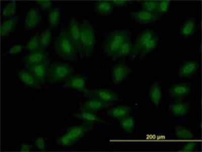Immunocytochemistry/ Immunofluorescence: SETD7 Antibody (5B4) [H00080854-M01]