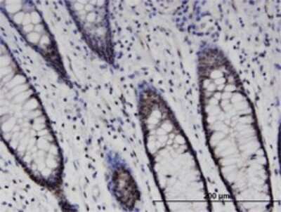 Immunohistochemistry-Paraffin: SETD7 Antibody (5B4) [H00080854-M01]