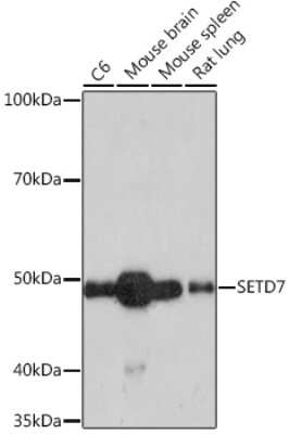 Western Blot: SETD7 Antibody (7Z6I8) [NBP3-16788]