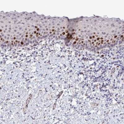 Immunohistochemistry-Paraffin: SETD7 Antibody [NBP2-34101]
