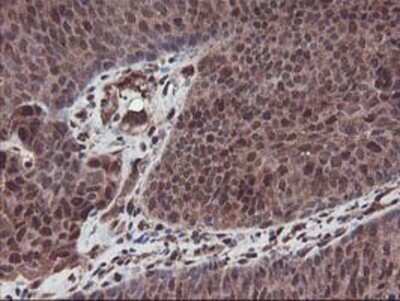 Immunohistochemistry: SETD7 Antibody (OTI2D10) - Azide and BSA Free [NBP2-74145]