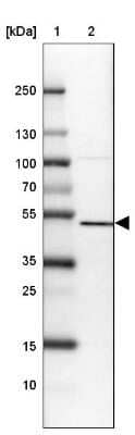 Western Blot: SETD7 Antibody [NBP2-34101]