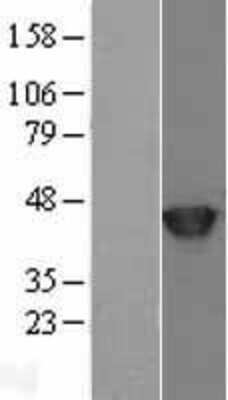 Western Blot: SETD7 Overexpression Lysate [NBL1-15869]