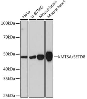 Western Blot: SETD8 Antibody (5M9P5) [NBP3-16339]