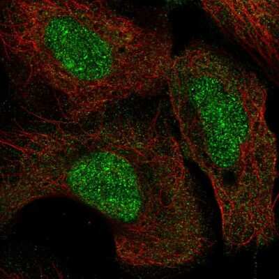 Immunocytochemistry/ Immunofluorescence: SETD8 Antibody [NBP2-55772]