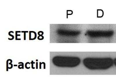 Western Blot: SETD8 AntibodyBSA Free [NBP1-91269]