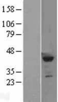 Western Blot: SETD8 Overexpression Lysate [NBL1-15870]