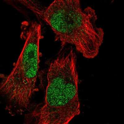 Immunocytochemistry/ Immunofluorescence: SETDB1 Antibody [NBP2-56678]