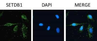 Immunocytochemistry: SETDB1 Antibody [NBP2-20322]
