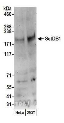 Western Blot: SETDB1 Antibody [NB100-79776]