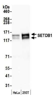 Western Blot: SETDB1 Antibody [NB100-79776]