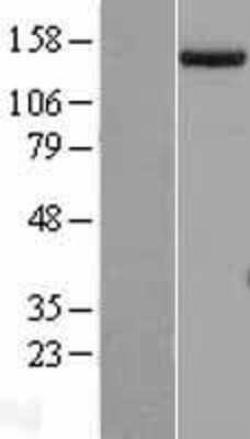 Western Blot: SETDB1 Overexpression Lysate [NBL1-15871]