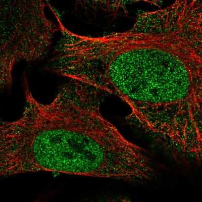 Immunocytochemistry/ Immunofluorescence: SETDB2 Antibody [NBP2-57394]