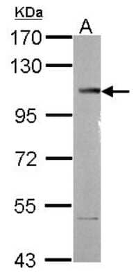 Western Blot: SETDB2 Antibody [NBP2-20323]