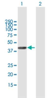 Western Blot: SETMAR Antibody [H00006419-B01P]