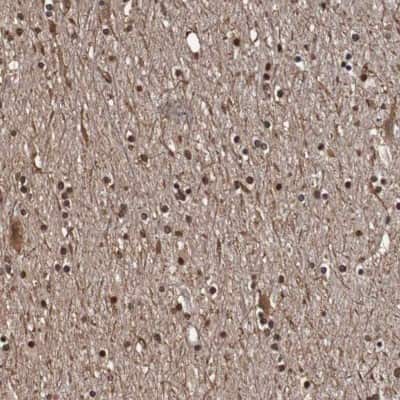 Immunohistochemistry-Paraffin: SEZ6/BSRP-C Antibody [NBP1-90945]