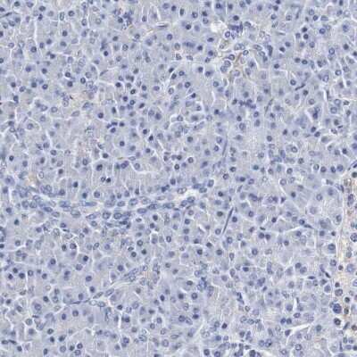 Immunohistochemistry-Paraffin: SEZ6/BSRP-C Antibody [NBP1-90945]