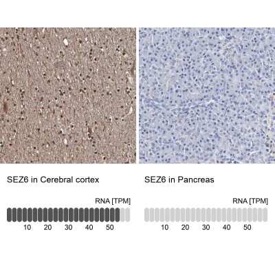 Immunohistochemistry-Paraffin: SEZ6/BSRP-C Antibody [NBP1-90945]