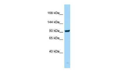 Western Blot: SEZ6/BSRP-C Antibody [NBP2-88248]