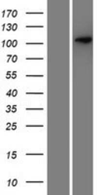 Western Blot: SEZ6/BSRP-C Overexpression Lysate [NBP2-04939]